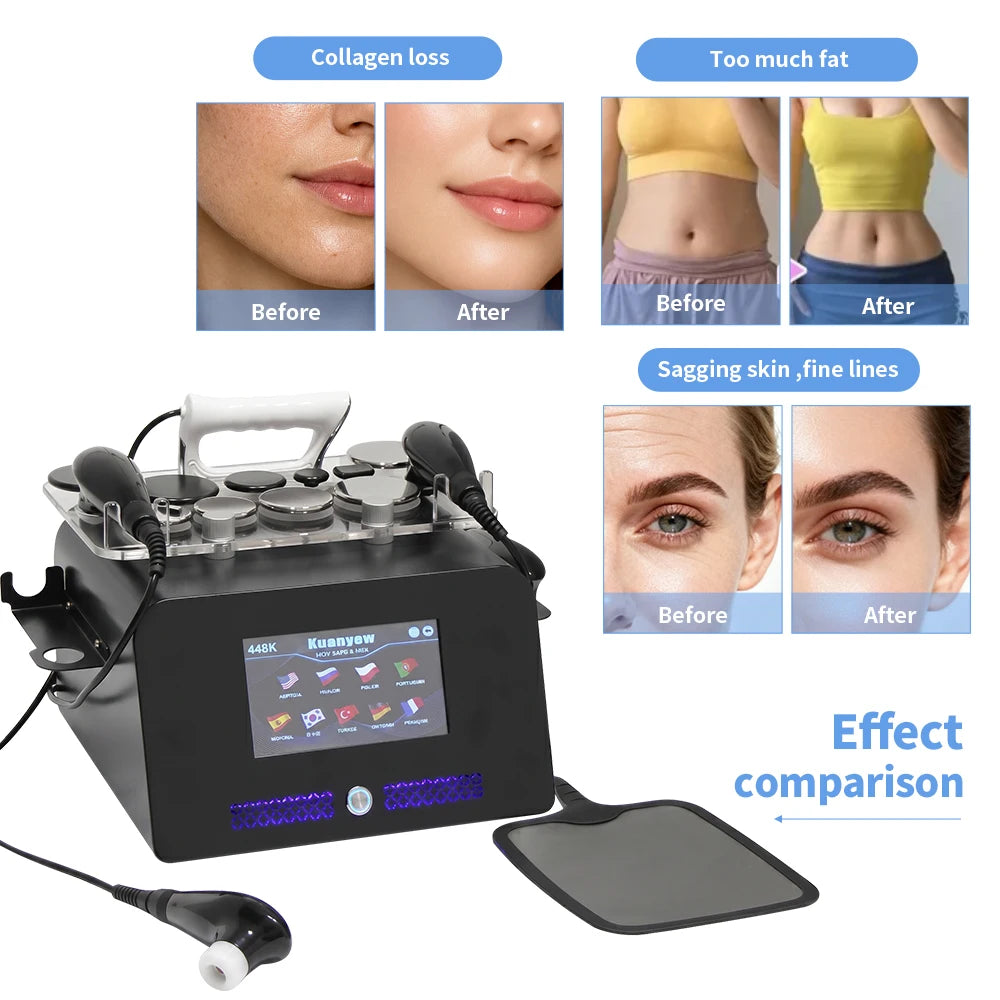 Aoko Professional Thermal Therapy Skin Lifting Spa Device